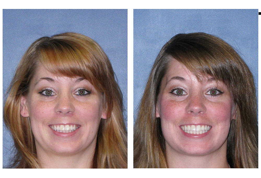 Burlington Dental