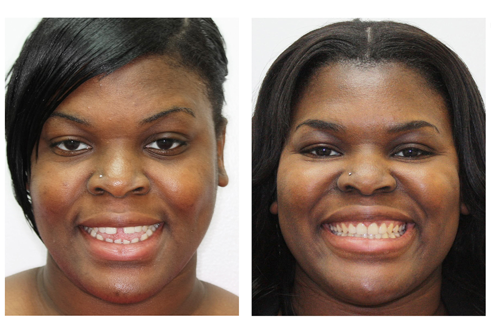 Burlington Dental