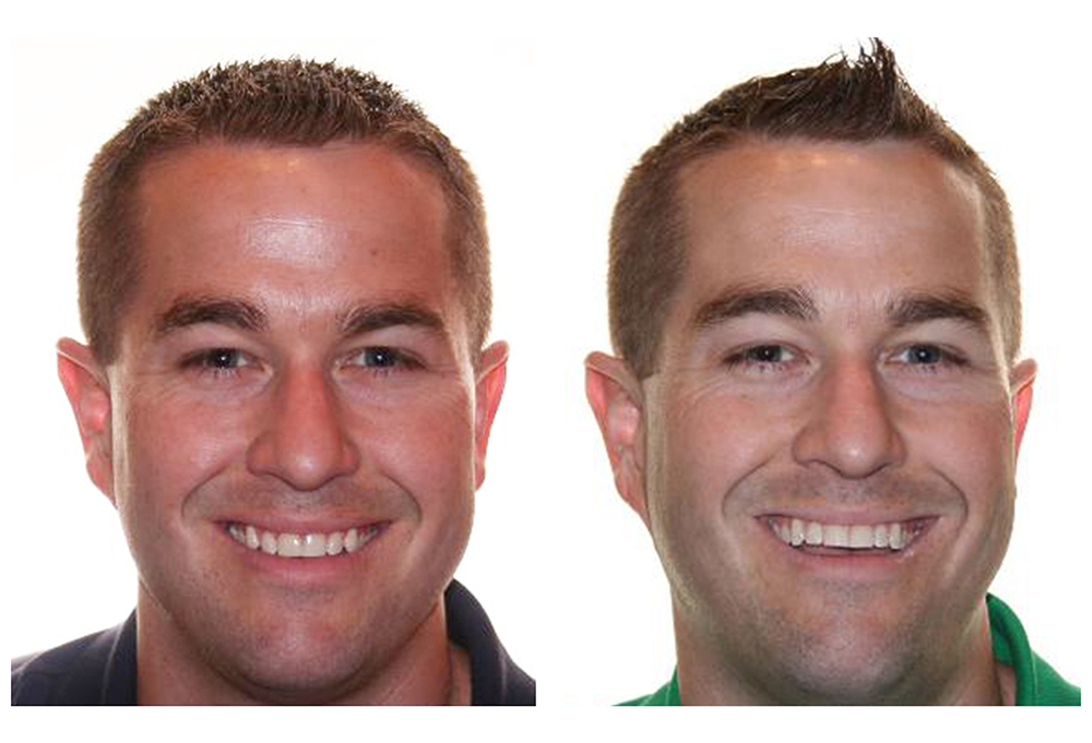 Burlington Dental