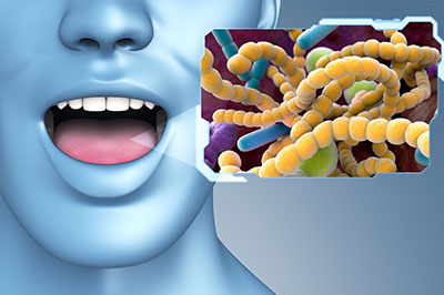 The image features a split-screen graphic with two distinct halves. On the left side, there is an illustration of a human head in profile, showcasing a blue skin tone and a mouth open as if to speak or sing. On the right side, there is a microscopic view of bacteria, colored in hues of yellow, green, and purple, set against a dark background that highlights their presence. The image appears to be digitally manipulated for educational or informational purposes, possibly relating to health, biology, or the human immune system.