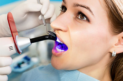 A woman receiving a dental cleaning, with a dental hygienist using an ultrasonic scaler to remove plaque from her teeth.