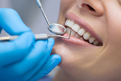 The image shows a dental hygiene professional performing a teeth cleaning procedure on a patient, with the patient s mouth open and the professional using dental tools to clean the teeth.