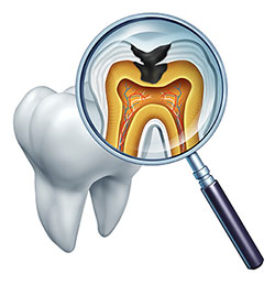 The image shows a magnified view of a human tooth with an open cavity, revealing the pulp chamber and nerve endings. A dental mirror is held up to the tooth, reflecting its interior structure.