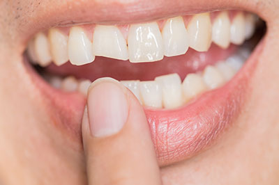 An image of a person with a wide smile, holding their finger up to their teeth.