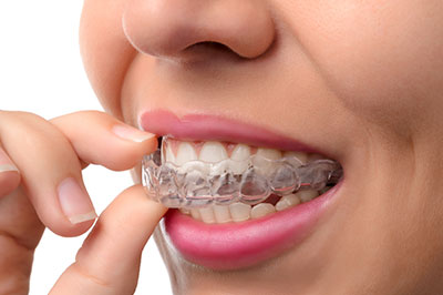 The image shows a person with a mouthful of dental floss, wearing an orthodontic appliance and smiling.