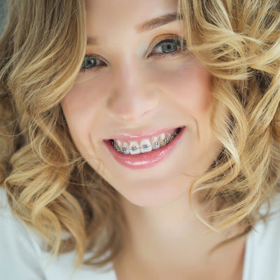 A woman with braces, wearing a white top and smiling at the camera.