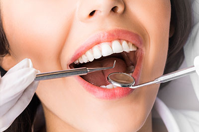 A woman undergoing a dental procedure, with a dentist using a drill on her teeth.