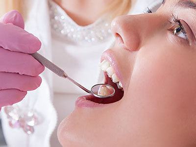 A dental professional performing a procedure on a patient s teeth, with the patient wearing a purple mouthguard and undergoing treatment.